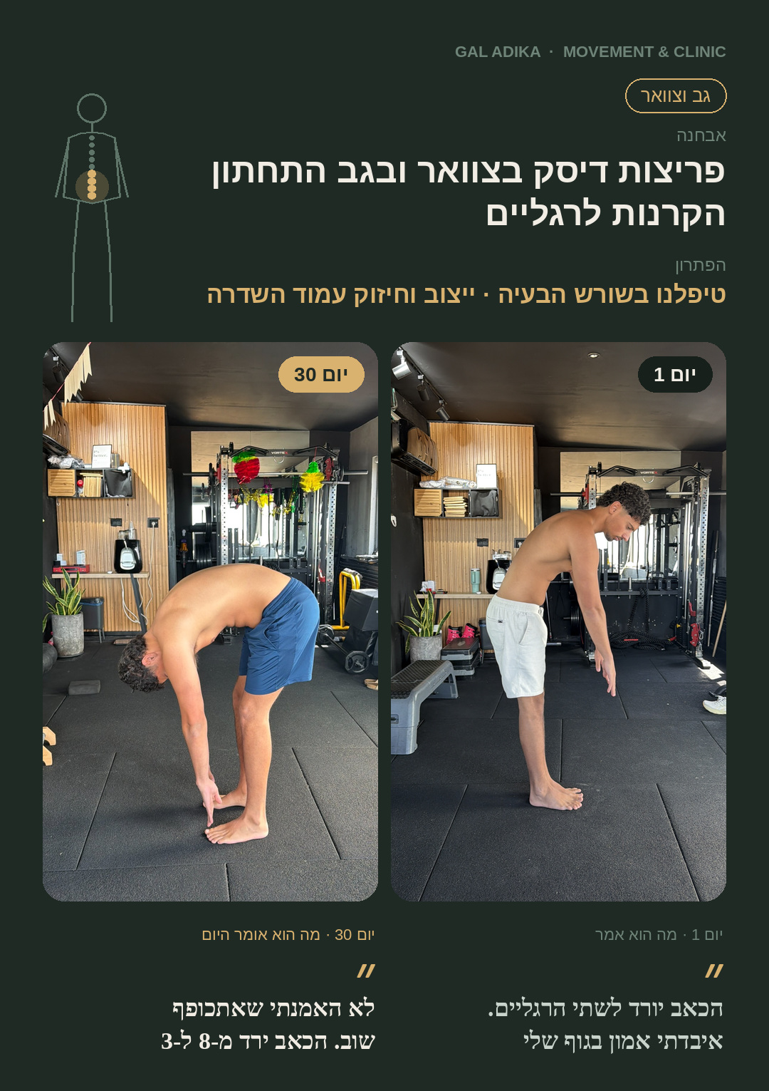 פריצות דיסק · צוואר וגב תחתון