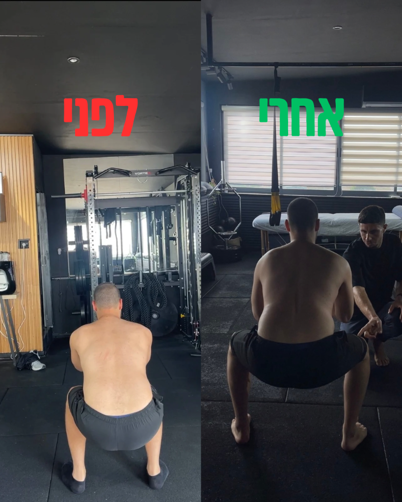לפני ואחרי — כף הרגל