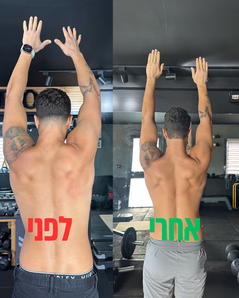 לפני ואחרי — כתף