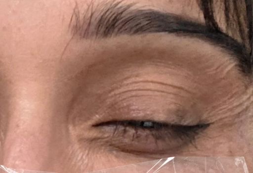 Crow's Feet before