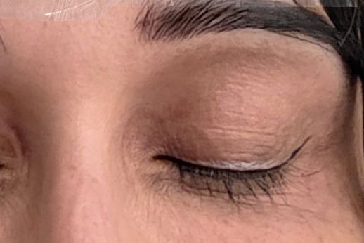 Crow's Feet after