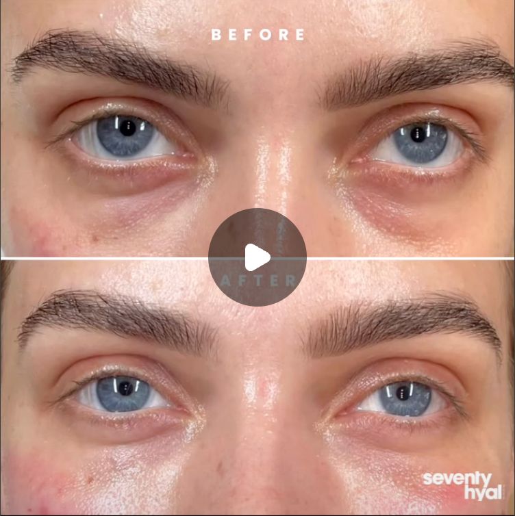 Hydrated Eye Finish before and after