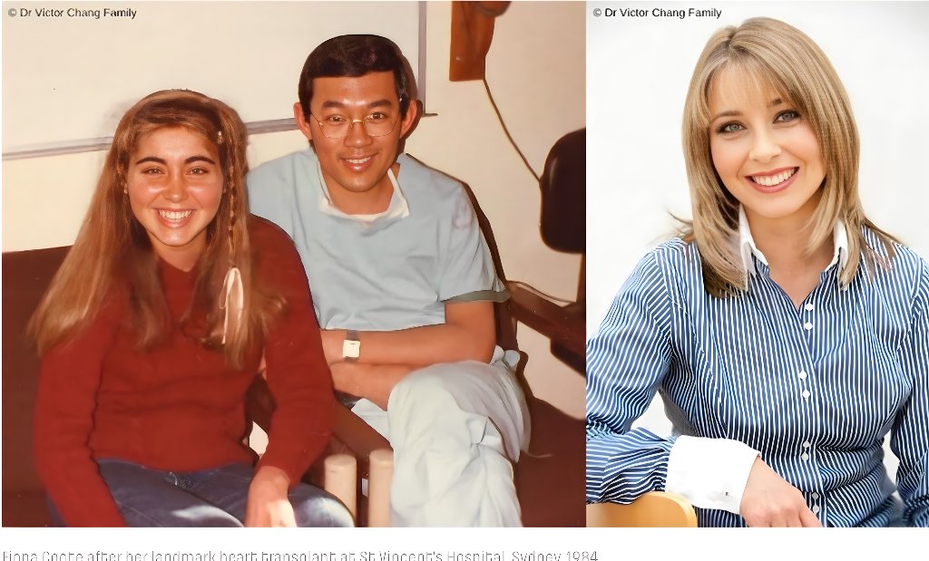 Fiona Coote before and after her landmark heart transplant