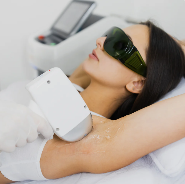 Laser Hair Removal