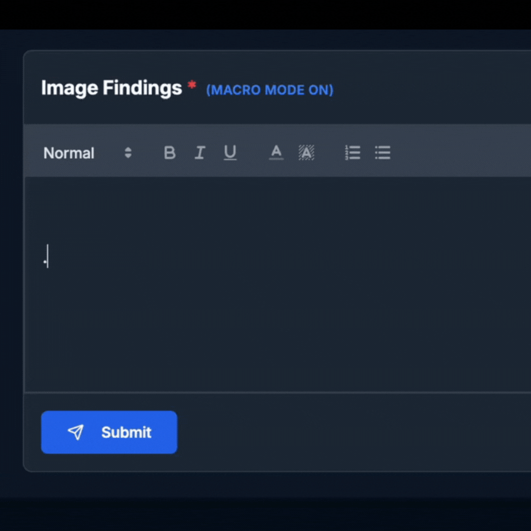 Custom Macros — Type to Expand