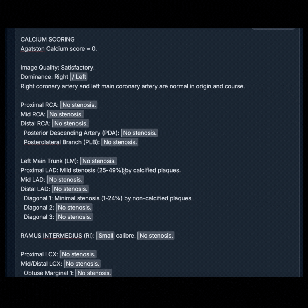 Custom Macros — Right-Click Insert