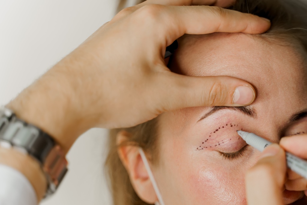 Oculoplastic Surgery
