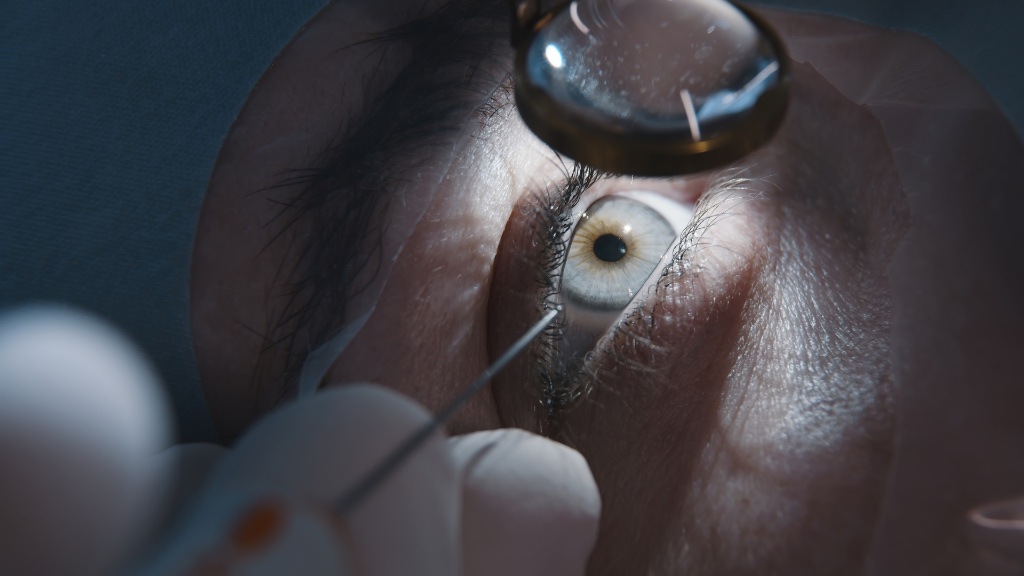 Diabetic Eye Exams