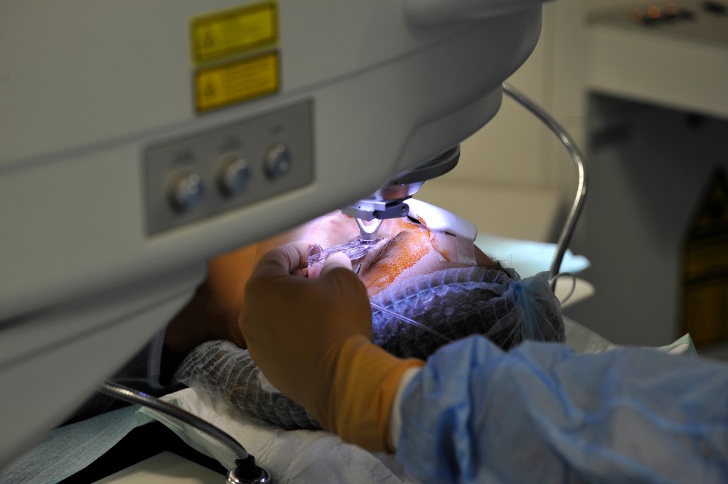 Is LASIK Right for You? Understanding Candidacy