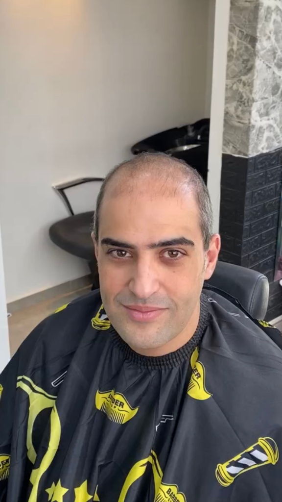 לפני