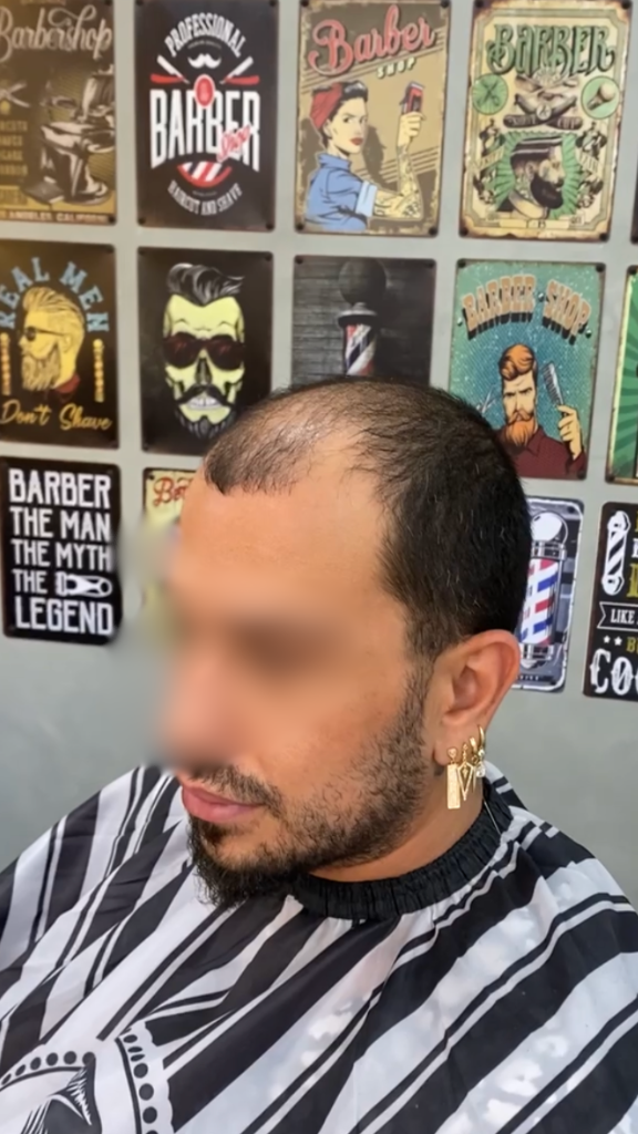 לפני
