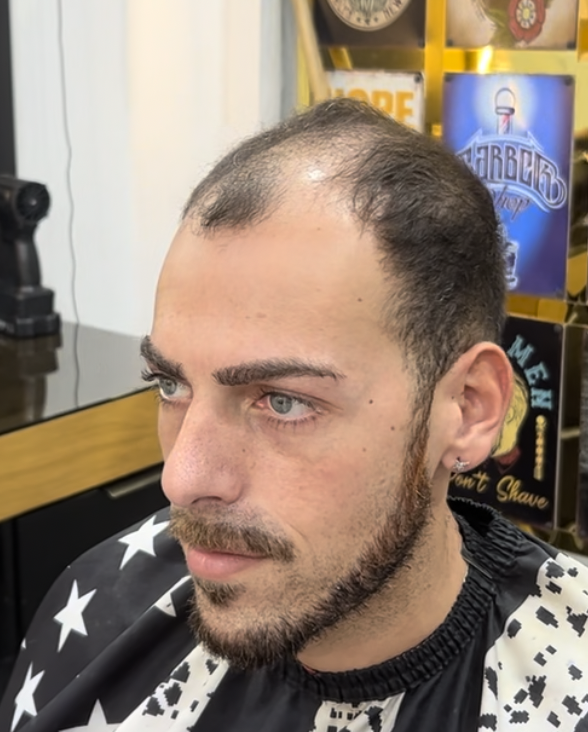 לפני