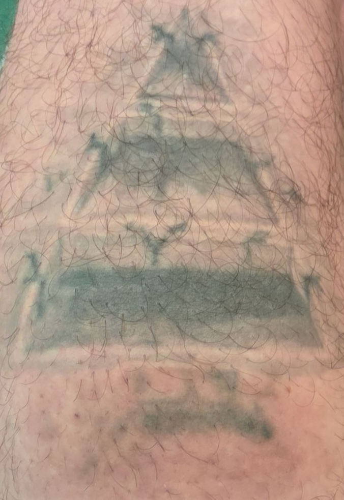 After 1 Session