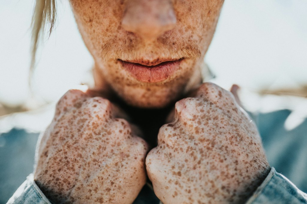 Skin Conditions We Treat
