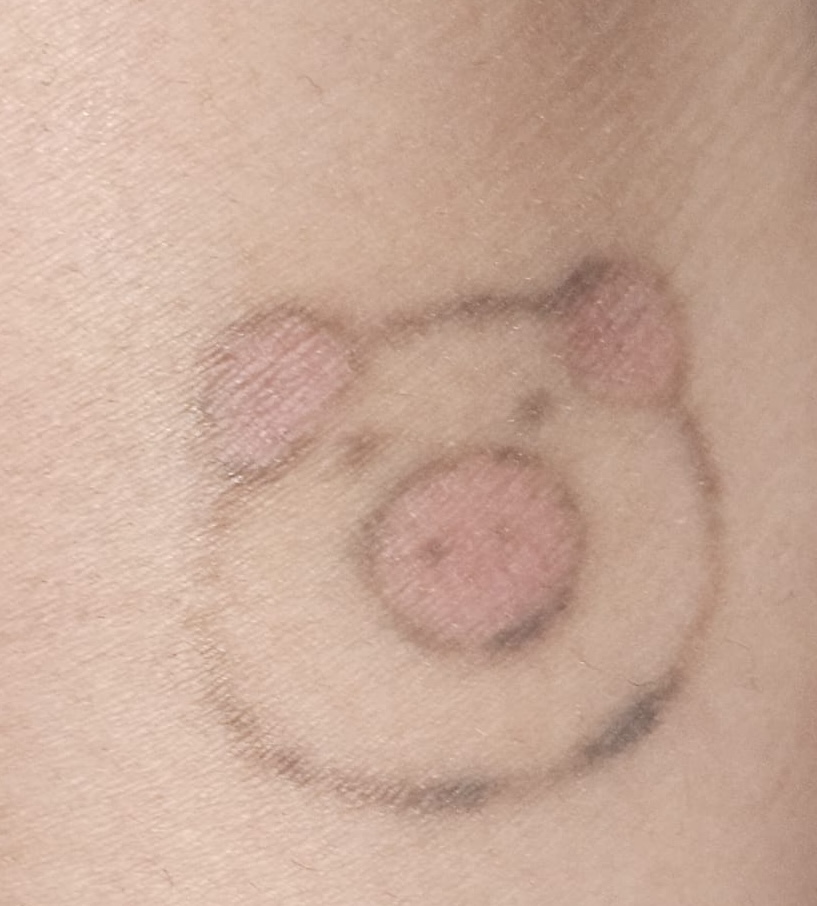 After 2 Sessions