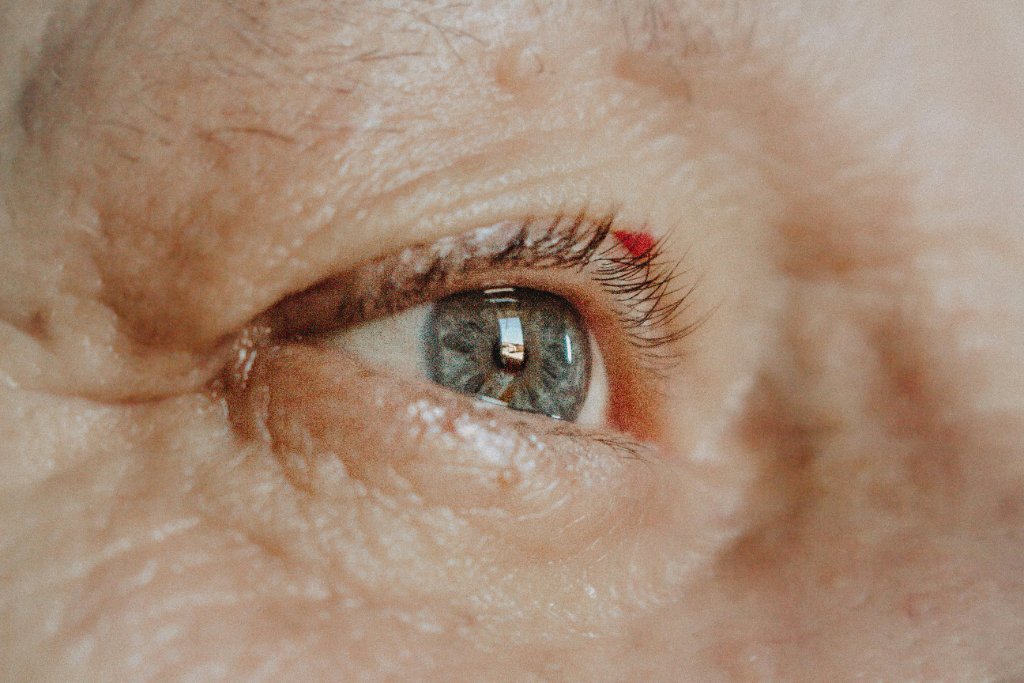 Skin Rejuvenation