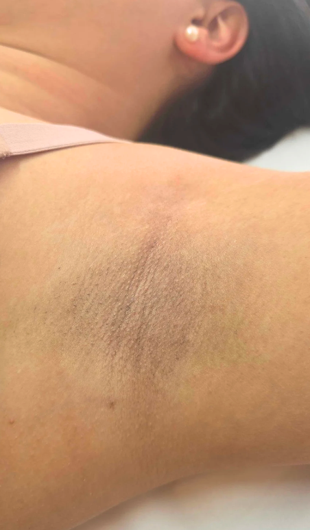 After 1 Session