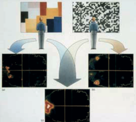 Fig 3 – PET scans showing colour and movement processing
