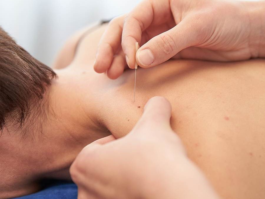 Myofascial Triggerpoint Needling