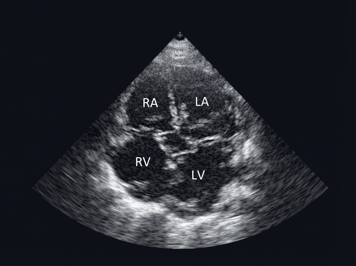 Cardiac ultrasound scan in black and white