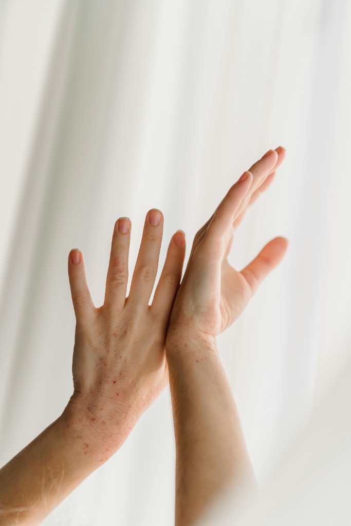 You can track your skin.