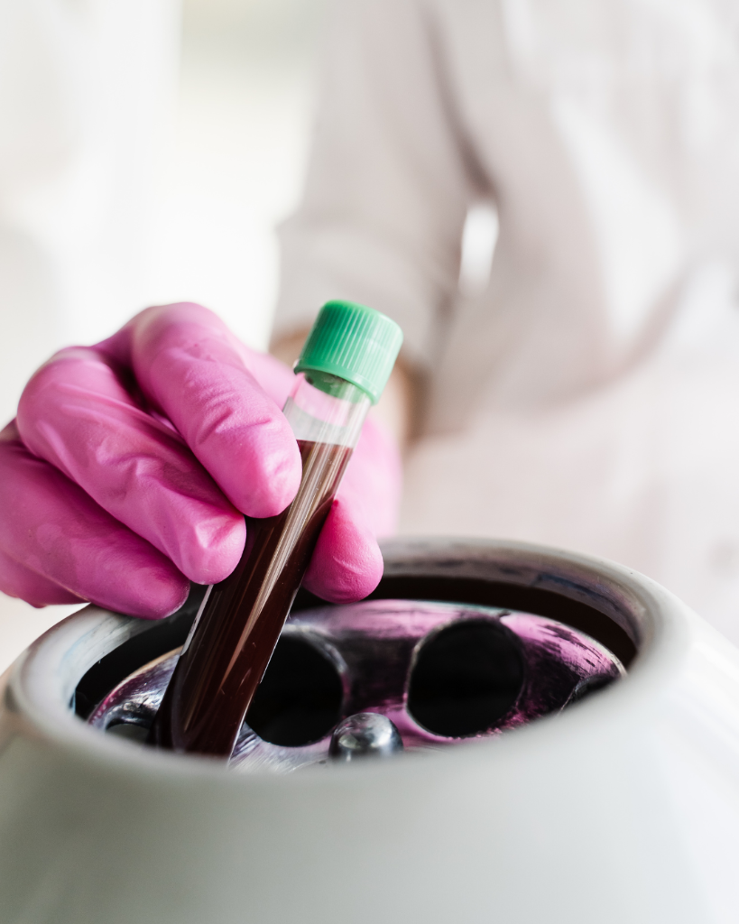 PRP Therapy