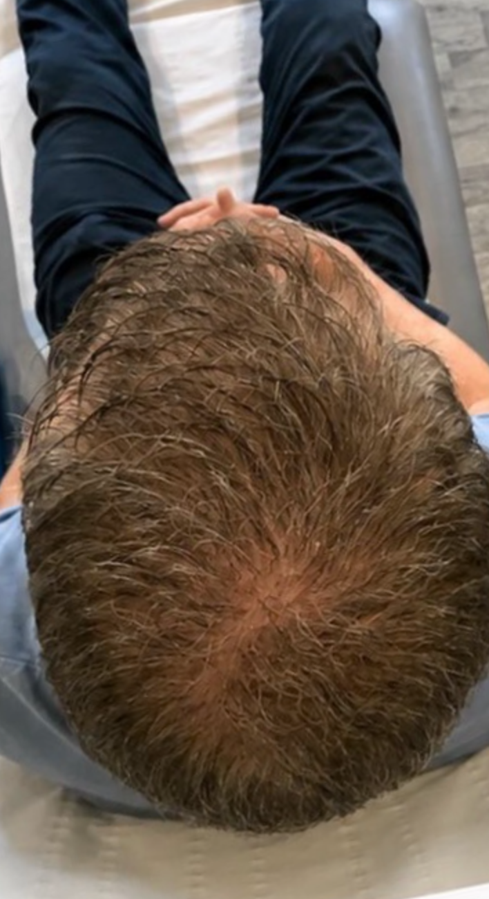 After - Crown