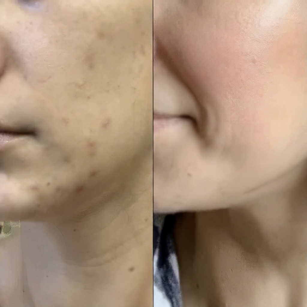 Antes e depois