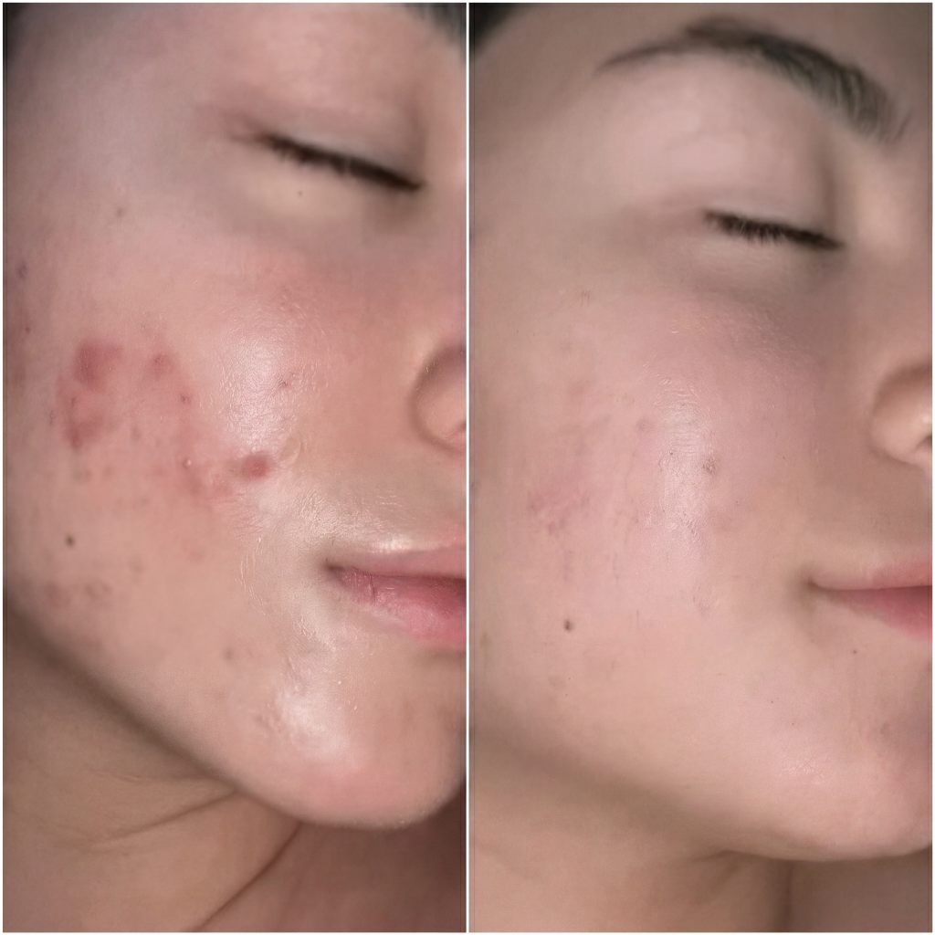 Antes e depois