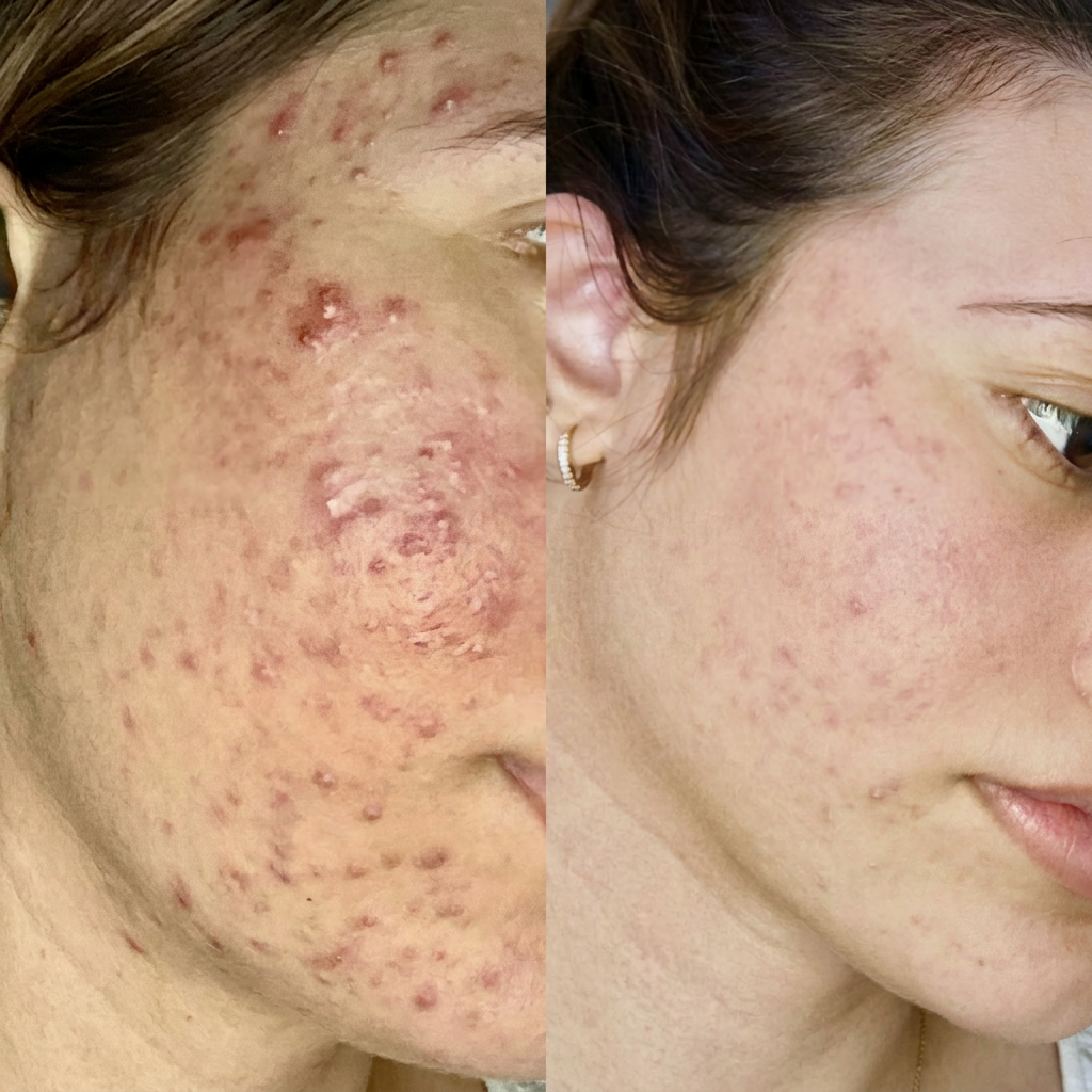 Antes e depois