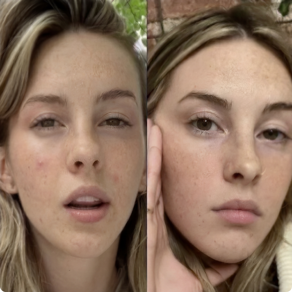 Antes e depois