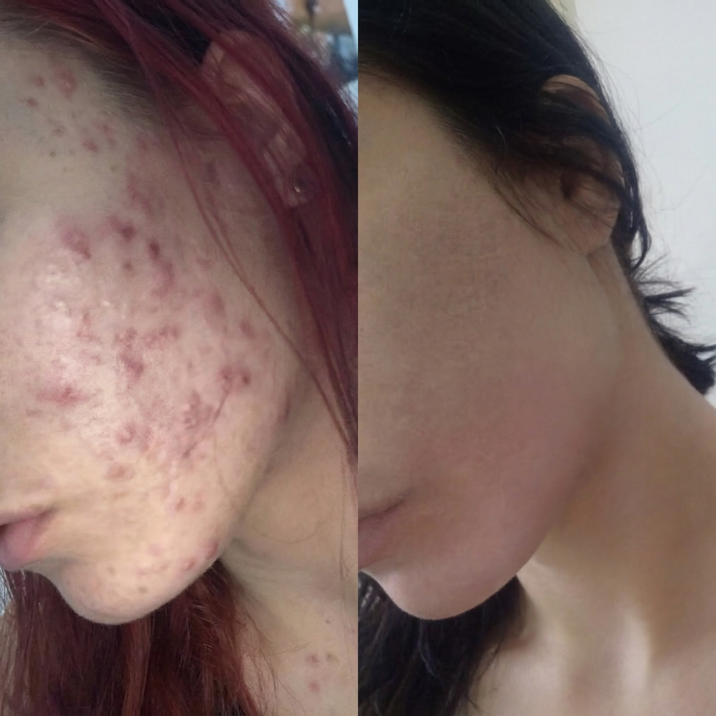Antes e depois