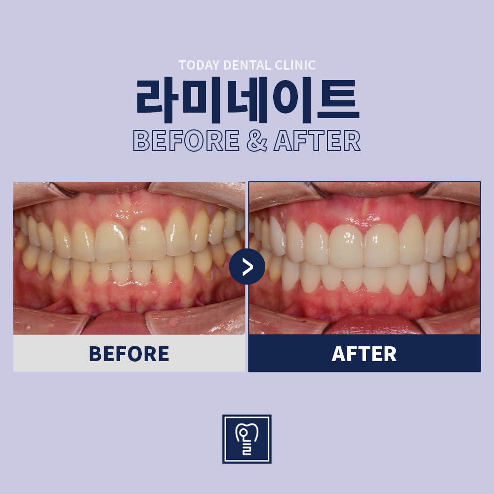 Case 4 · Before / After