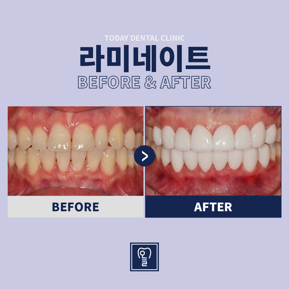 Case 6 · Before / After