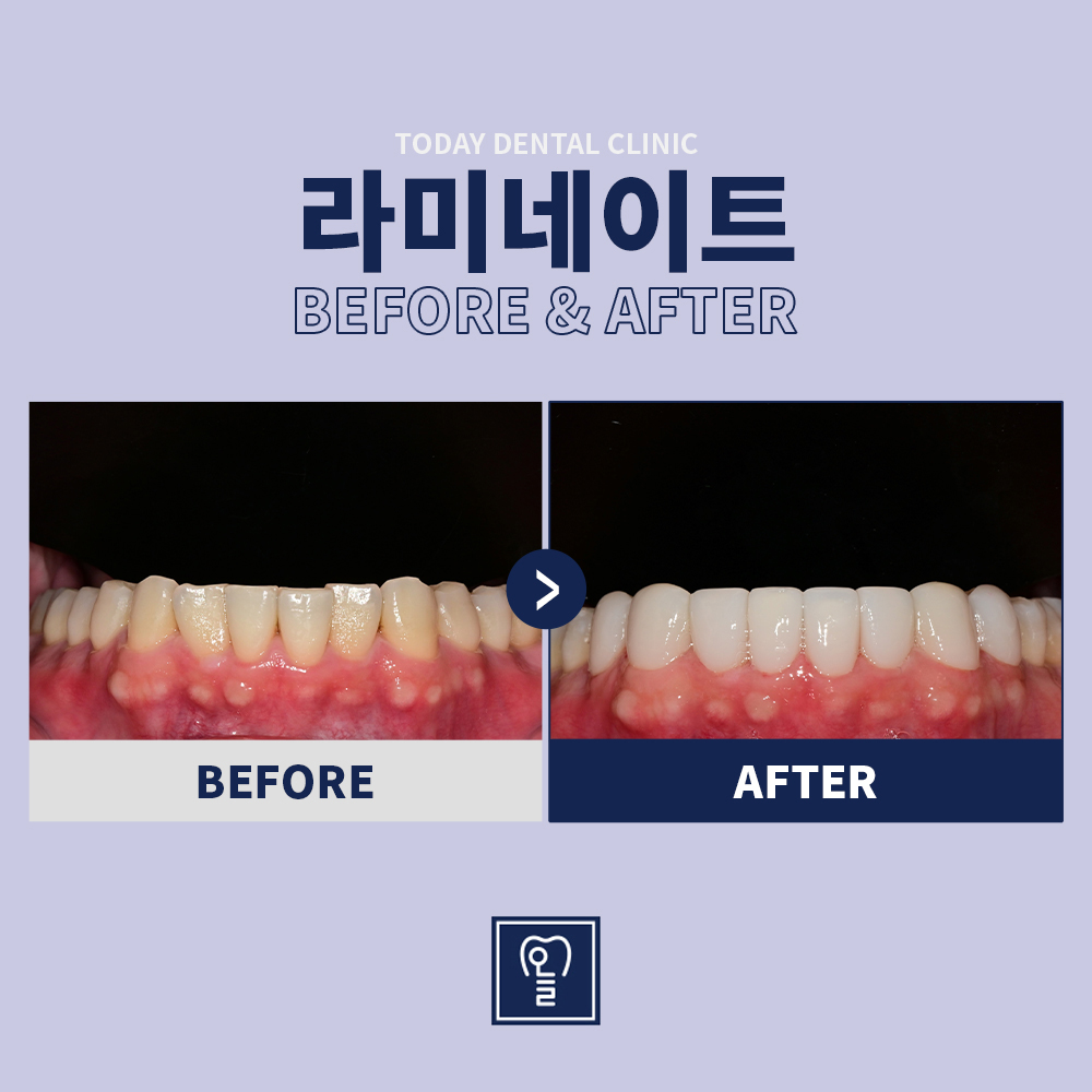 Case 5 · Before / After