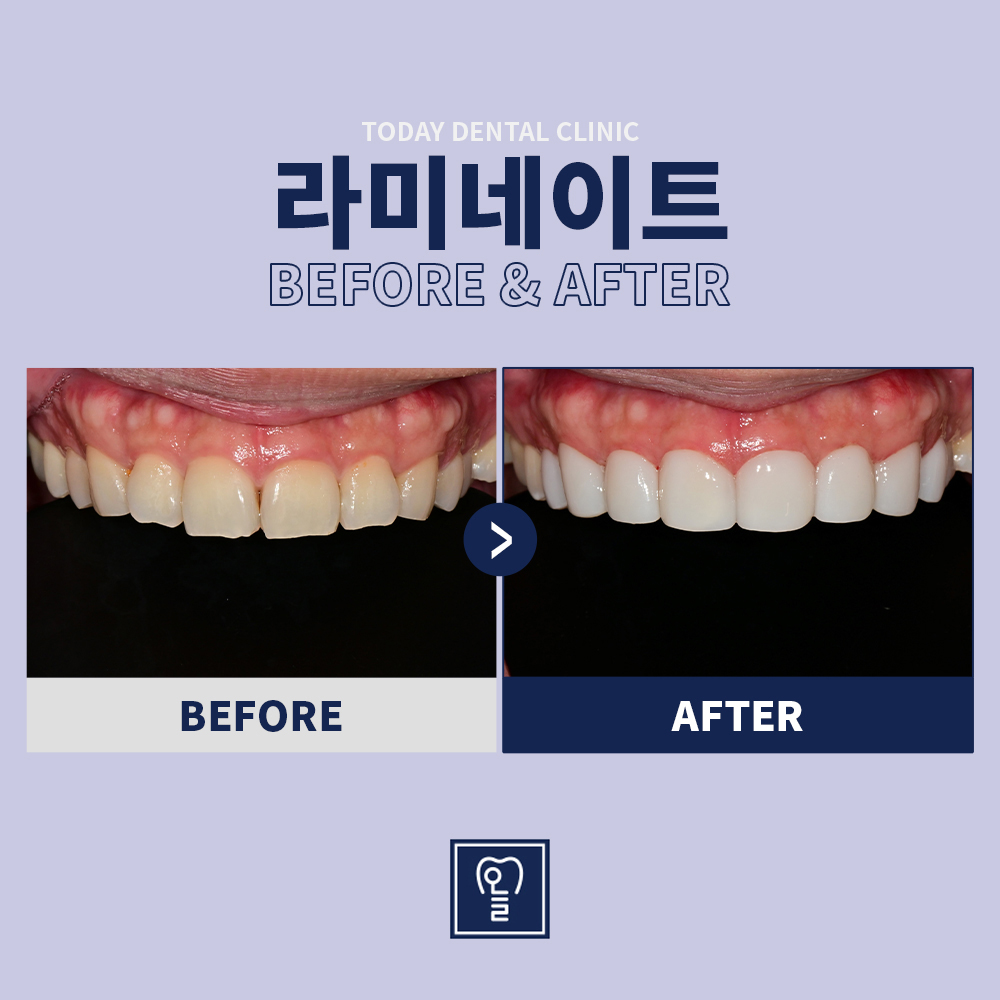 Case 3 · Before / After
