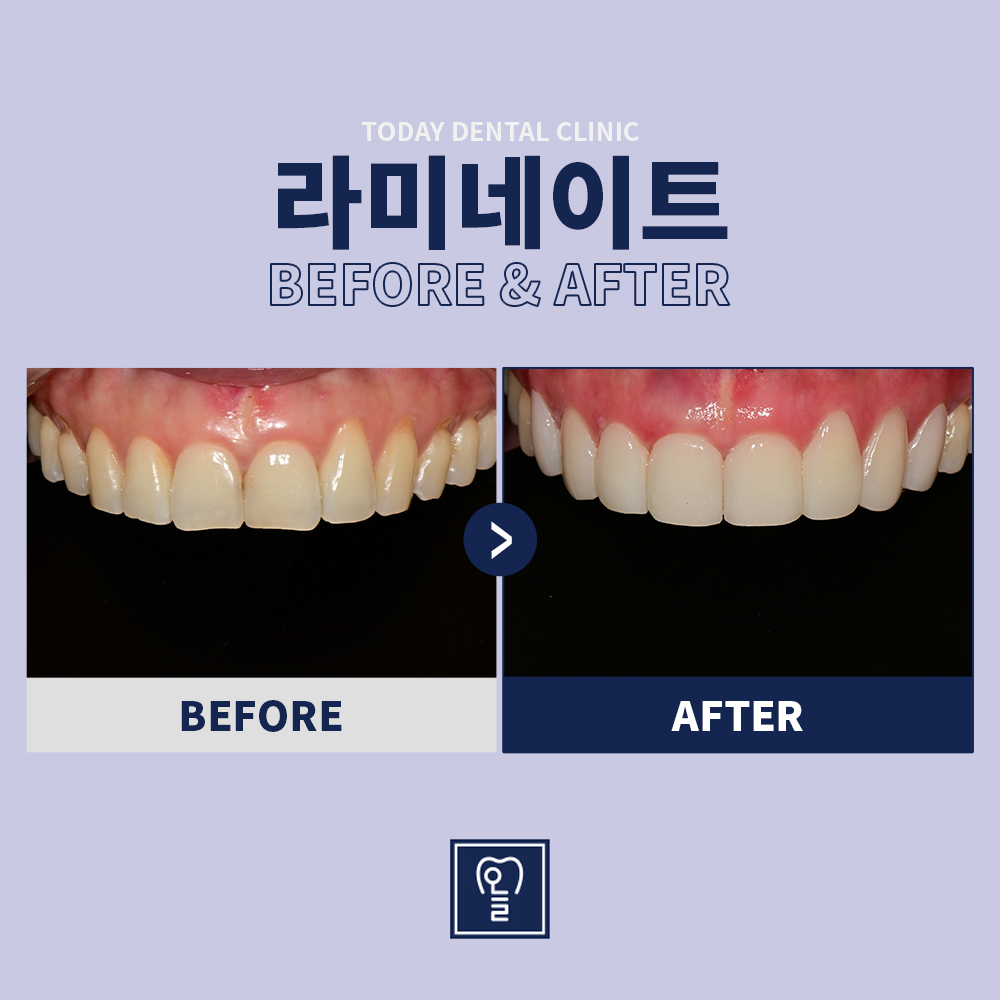 Case 2 · Before / After