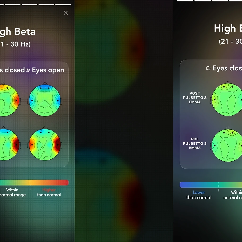 Pulsetto Review: What Our Brain Scans and Sleep Data Show