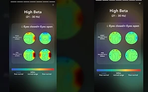 Pulsetto Review: What Our Brain Scans and Sleep Data Show