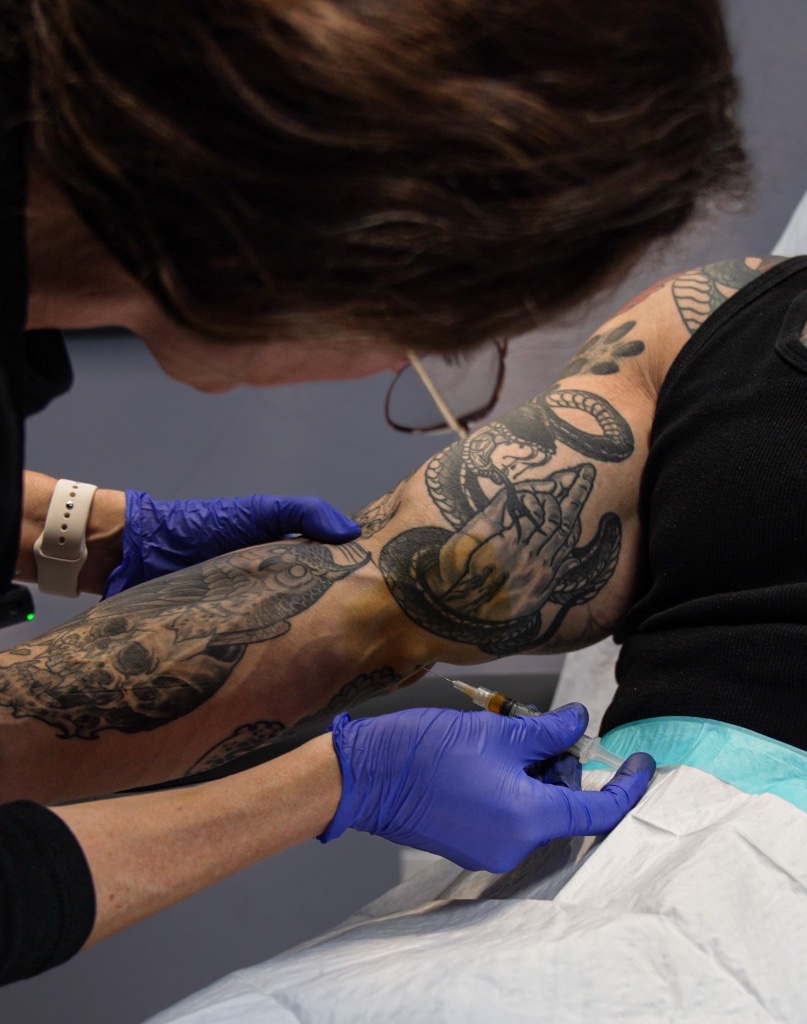 Prolotherapy treatment