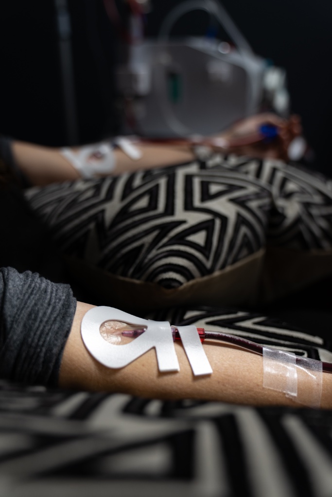 EBOO Therapy