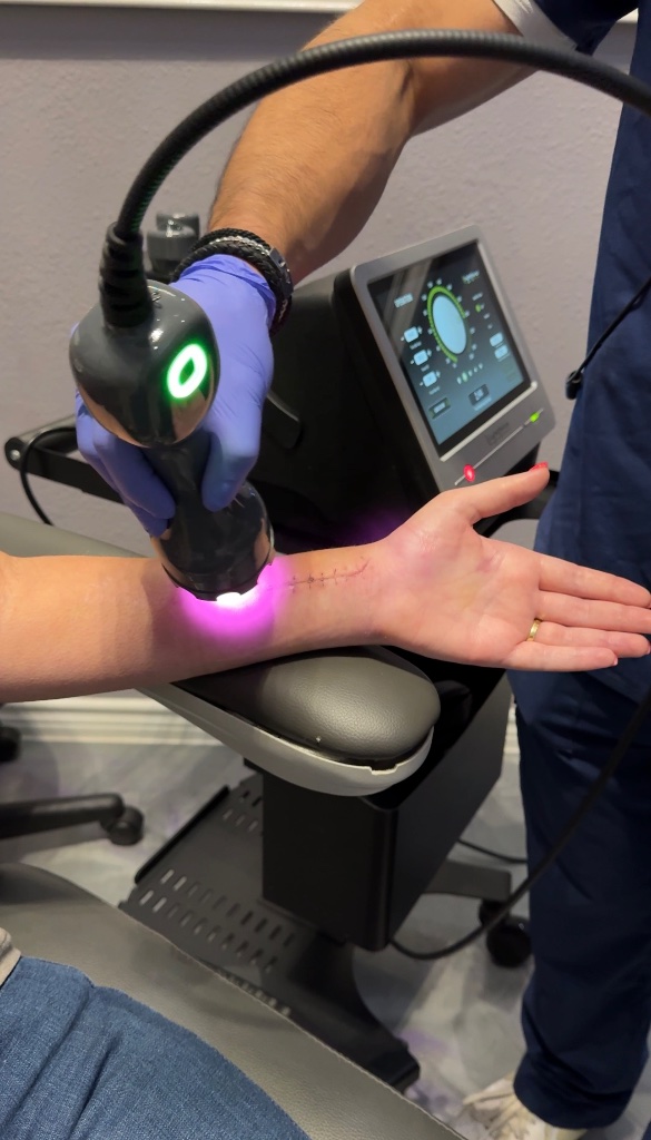 LightForce Laser Therapy 1