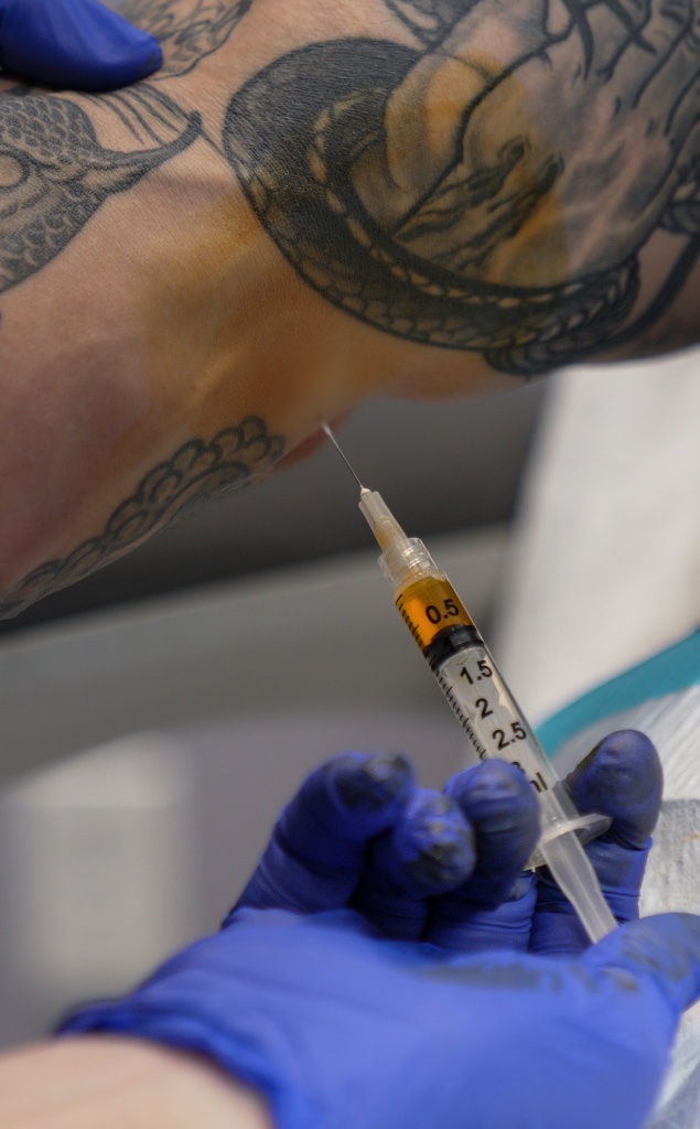 Prolotherapy treatment
