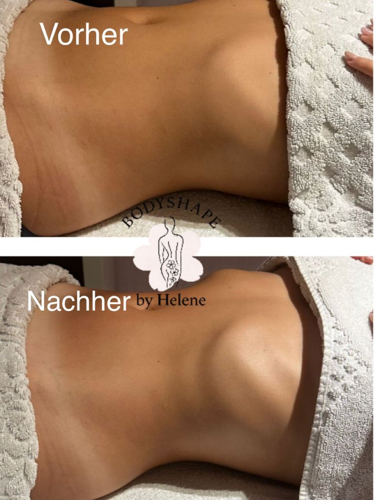 Vorher / Nachher – Bauch