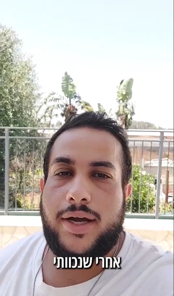 שקד מארק