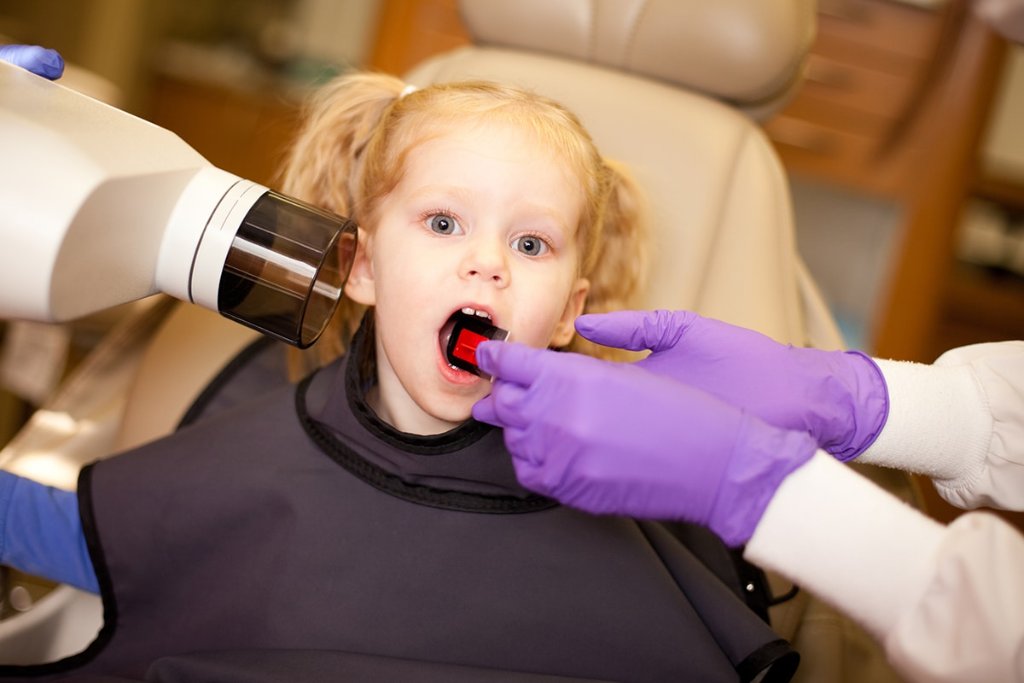 Hidden Sugars That Harm Your Child's Smile