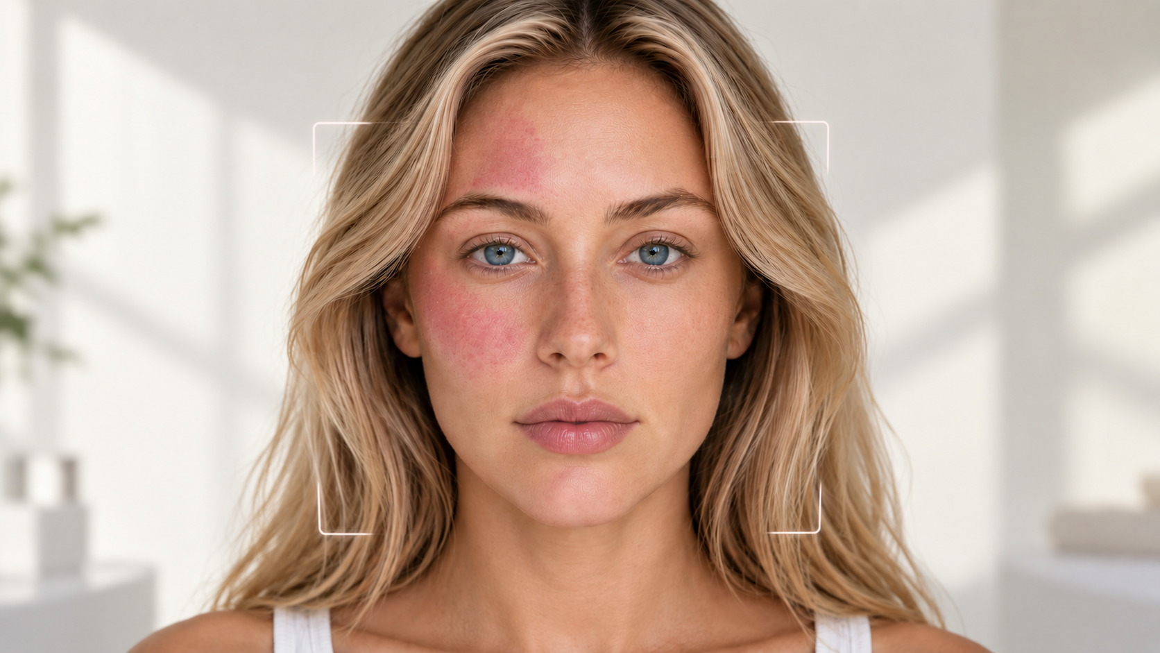 Skin scanner