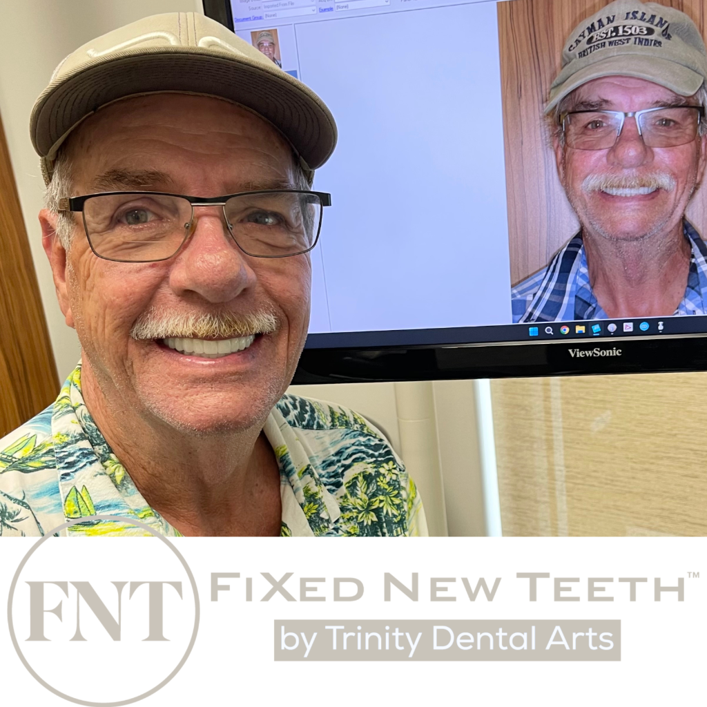 Patient displaying fixed implant smile transformation, before image on screen — Trinity Dental Arts FL
