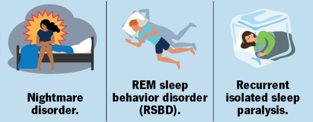 Illustration of REM parasomnias including REM sleep behavior disorder and sleep paralysis