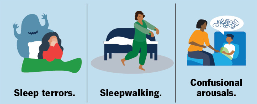 Illustration of NREM parasomnia types including sleepwalking and sleep terrors